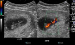 career_sonographer Sonography – What is it?