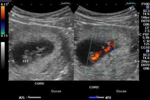 career_sonographer Sonography – What is it?